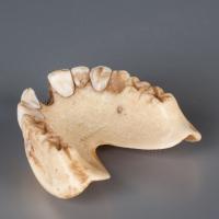 Waterloo Teeth